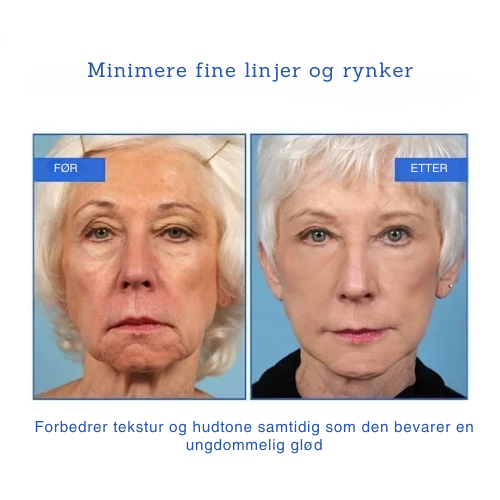 Rynkefri Ansiktserum Revolusjon